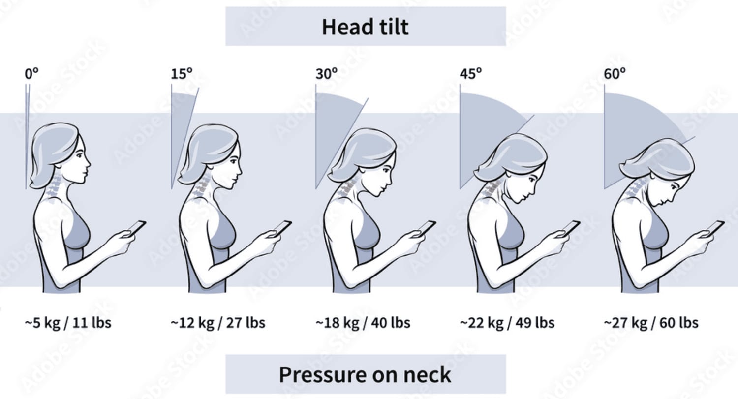 Chart showing how the weight load on the neck joints increases as the head bends forward, from 10 to 12 pounds in neutral up to about 60 pounds at 60 degrees