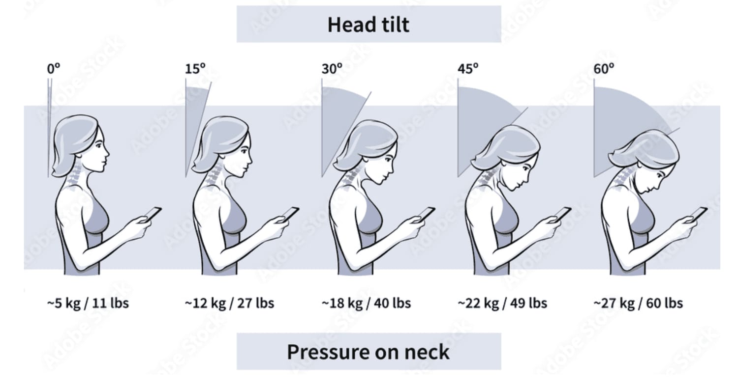 Woman holding her neck with her head tilted forward, showing the strain of tech neck posture