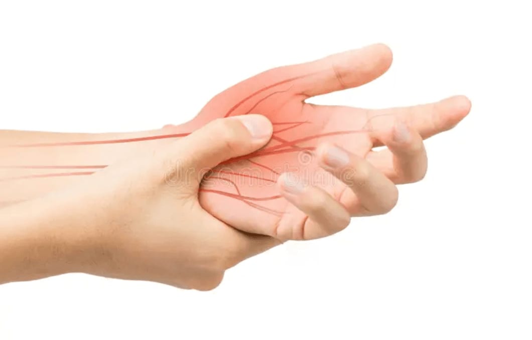 Illustration of nerve pain radiating along a nerve, the kind that can cause shooting pain with certain movements