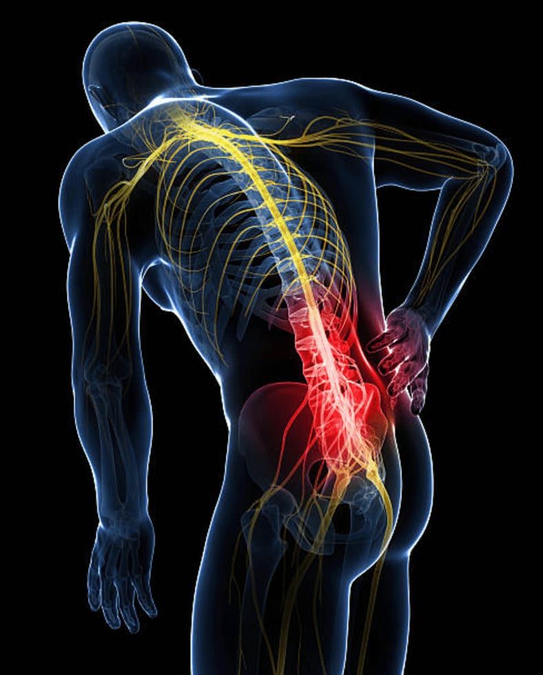 Think You Have a Pinched Nerve? Let’s Break (and Beat) It Down!